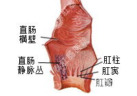 直肠炎百科