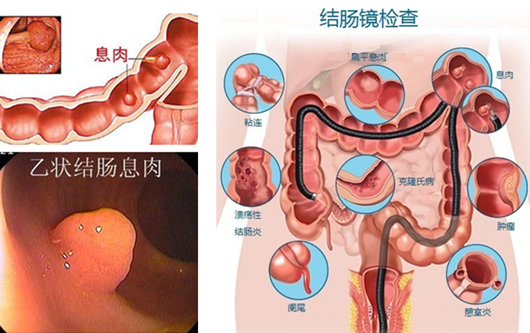 医博肛肠医院怎么样