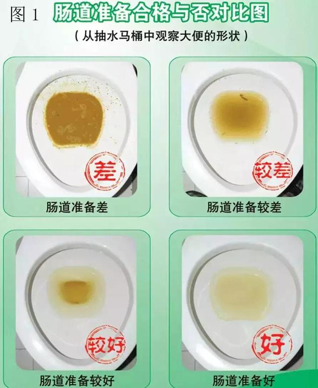 直肠癌便血特点
