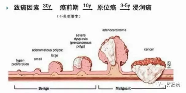 肛瘘跟痔疮的区别
