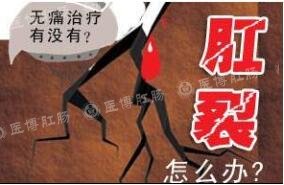 福州和平医院治痔疮